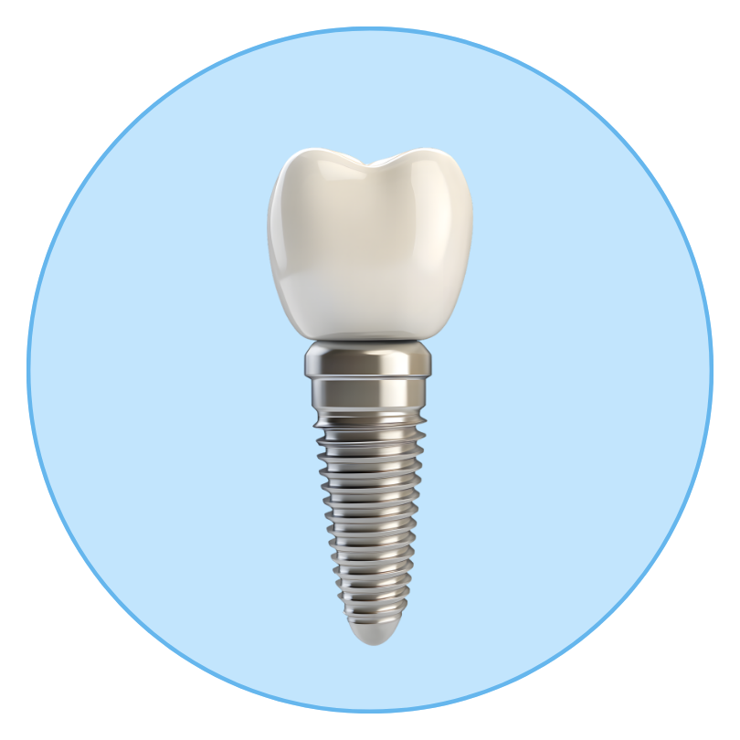 Dental Implants