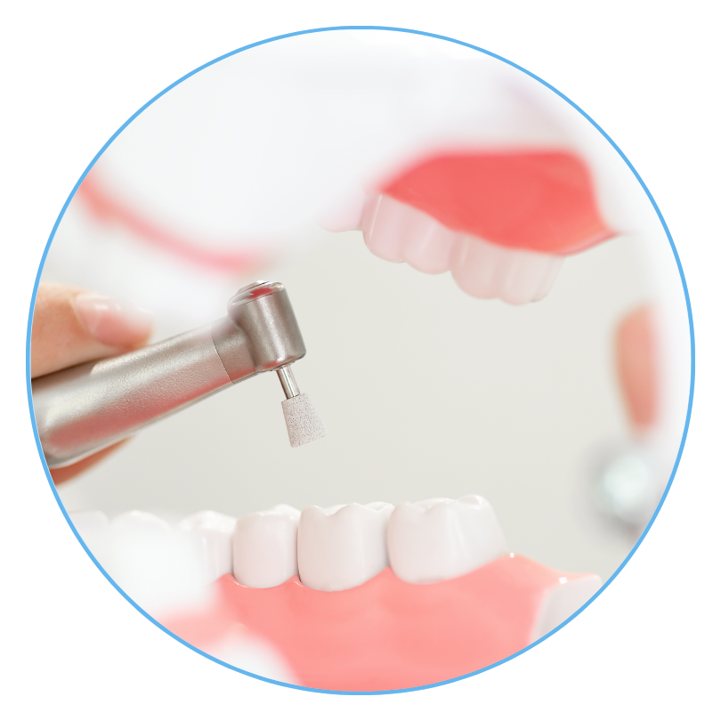 Teeth Cleaning