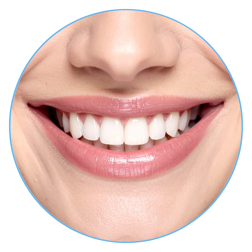 Teeth Whitening